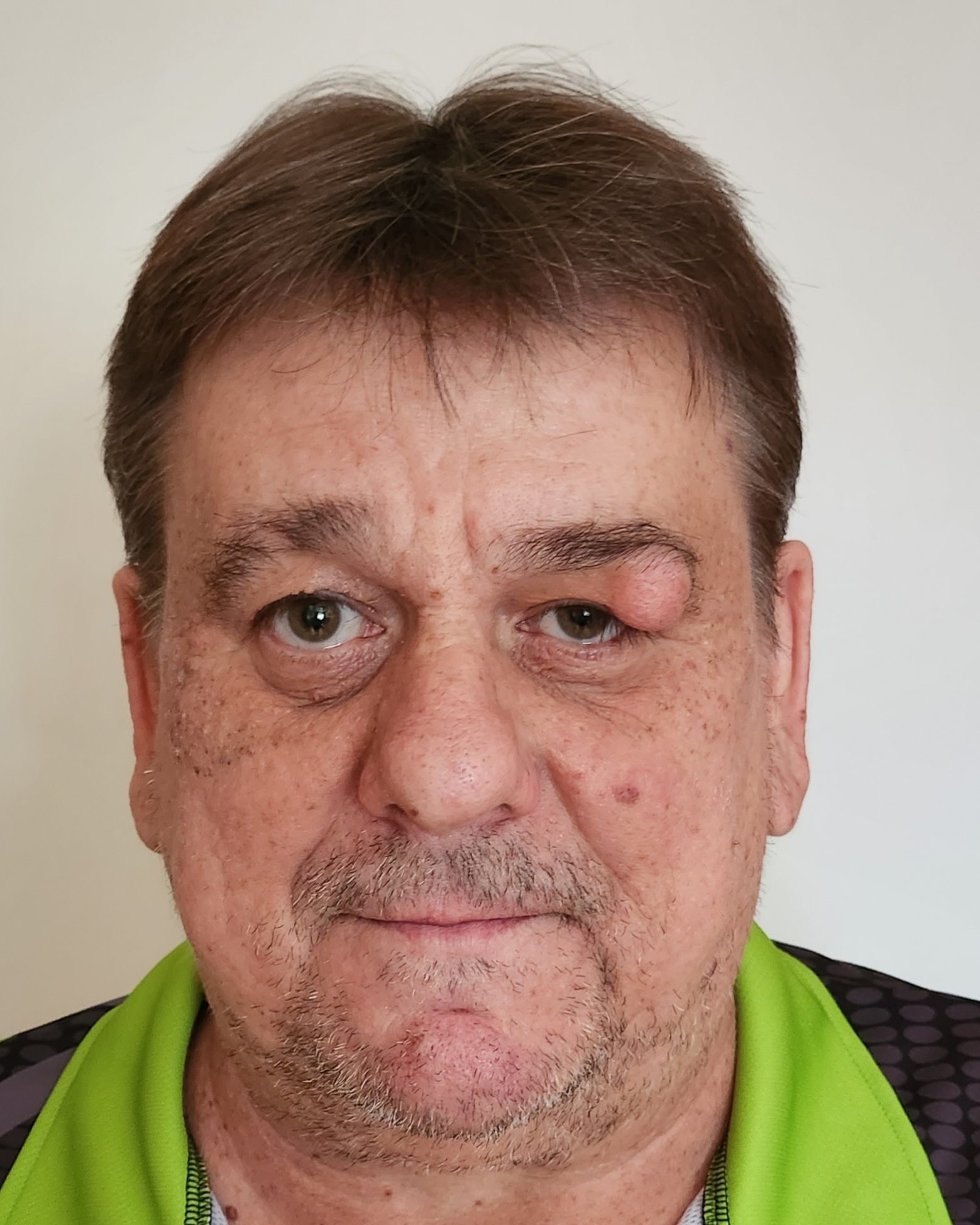 Günther Leinfellner